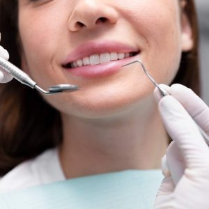 estetica dental