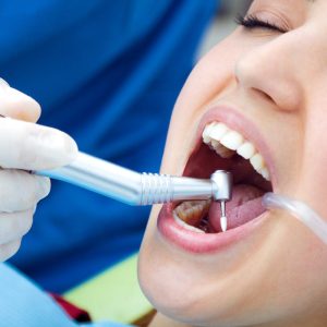 Implantes