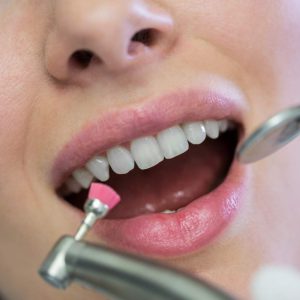 estetica dental