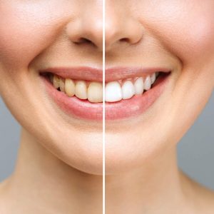 estetica dental