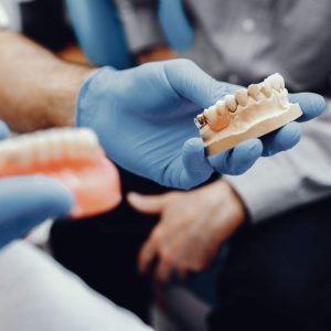 Implantes