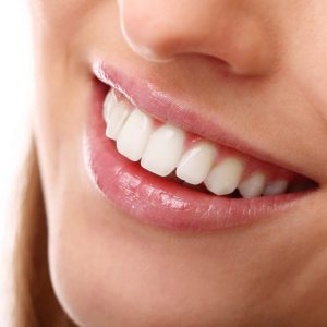 estetica dental
